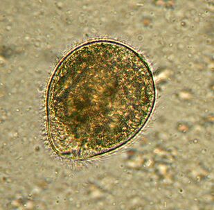 Balantidium adalah parasit protozoa terbesar