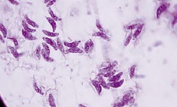 protozoa parasit toxoplasma gondii agen penyebab toksoplasmosis