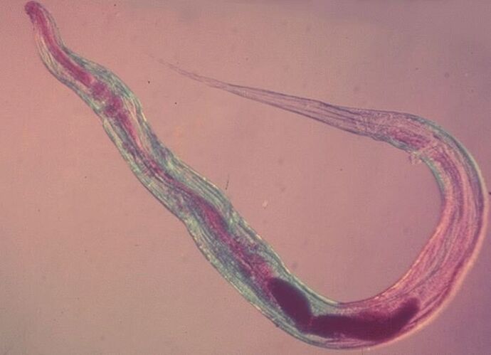 Cacing kremi di bawah mikroskop